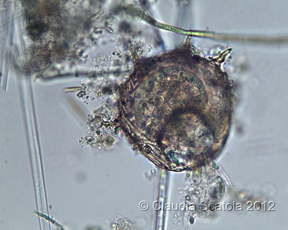 Centropyxis aculeata